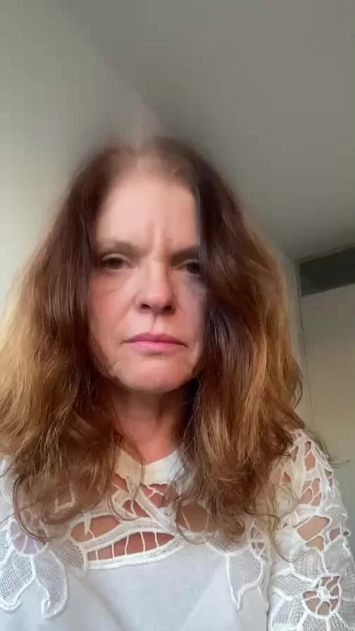 Live!! Desafíos en acogida y adopción ❤️❤️❤️